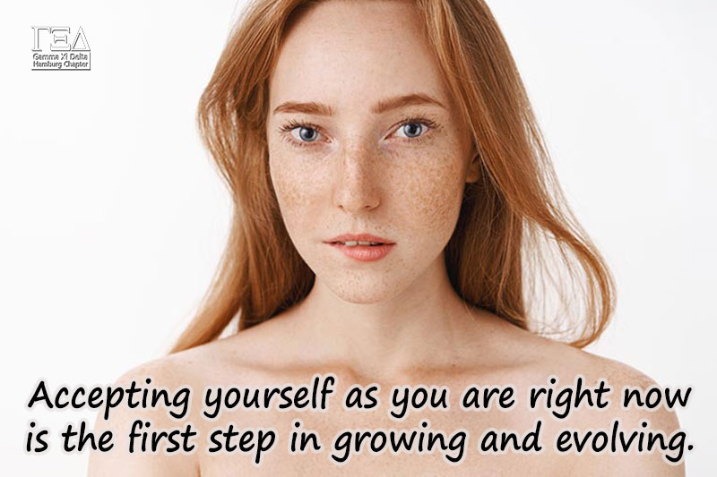 Accepting yourself as you are right now is the first step in growing and evolving.